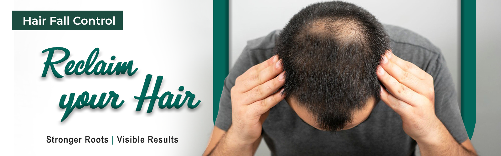 Hair Fall Control Hospitals